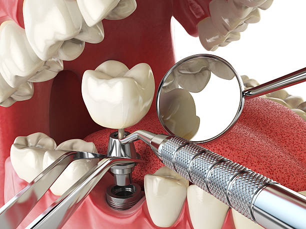 Best Urgent Tooth Repair  in Bay City, MI